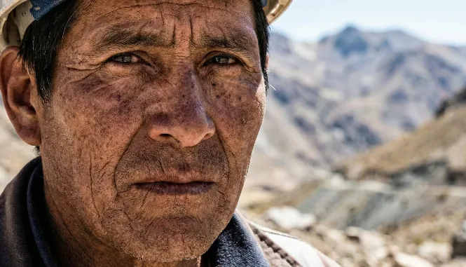 Hombre mostrando señales de deterioro de la piel. Imagen ilustrativa de ACERO Y ROCA